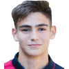Pitzalis